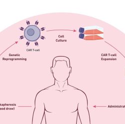 Understanding the Difference Between CAR T-Cell Therapy and Other Cancer Immunotherapies