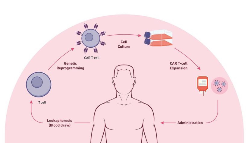 Understanding the Difference Between CAR T-Cell Therapy and Other Cancer Immunotherapies