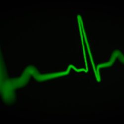 Close-up of a green heart rate monitor display showing an ECG waveform.