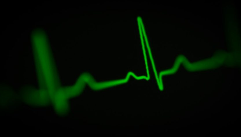 Close-up of a green heart rate monitor display showing an ECG waveform.